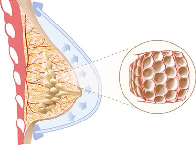 تزریق چربی سینه / کاربرد تزریق چربی سینه