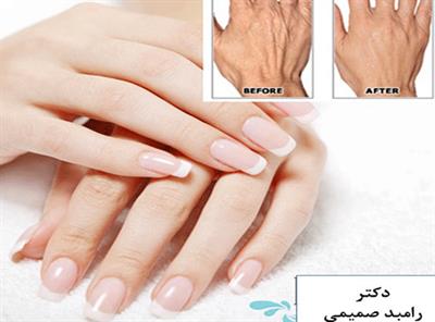 چگونه دستهای جوانتر و با طراوت تری داشته باشیم؟