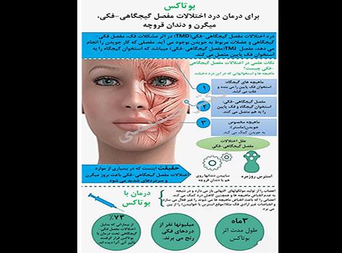 تزریق بوتاکس برای دندان قروچه و میگرن