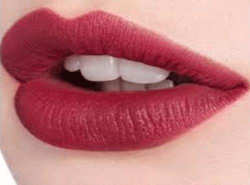 تزریق ژل لب(دکتر صمیمی)