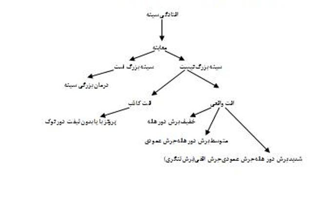 کوچک کردن سینه و لیفت سینه - نوع درمان در انواع افتادگی